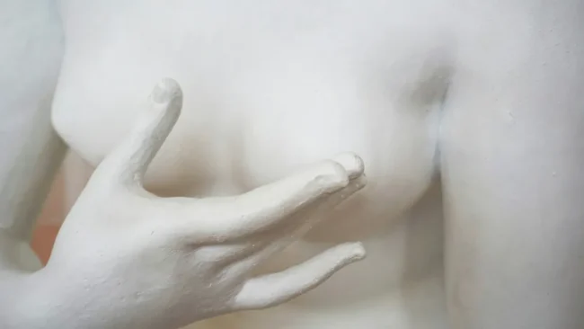 Cães podem detectar presença de câncer através do olfato; entenda (1)